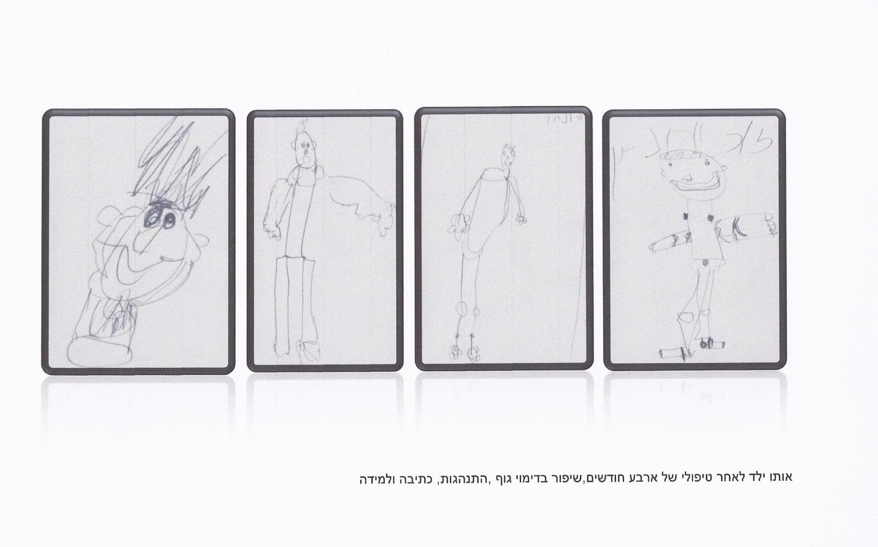 גל - אחרי טיפול של 4 חודשים