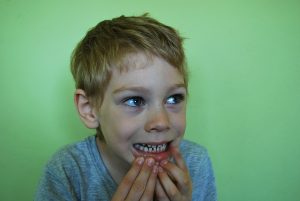 baby-teeth-1402483_640